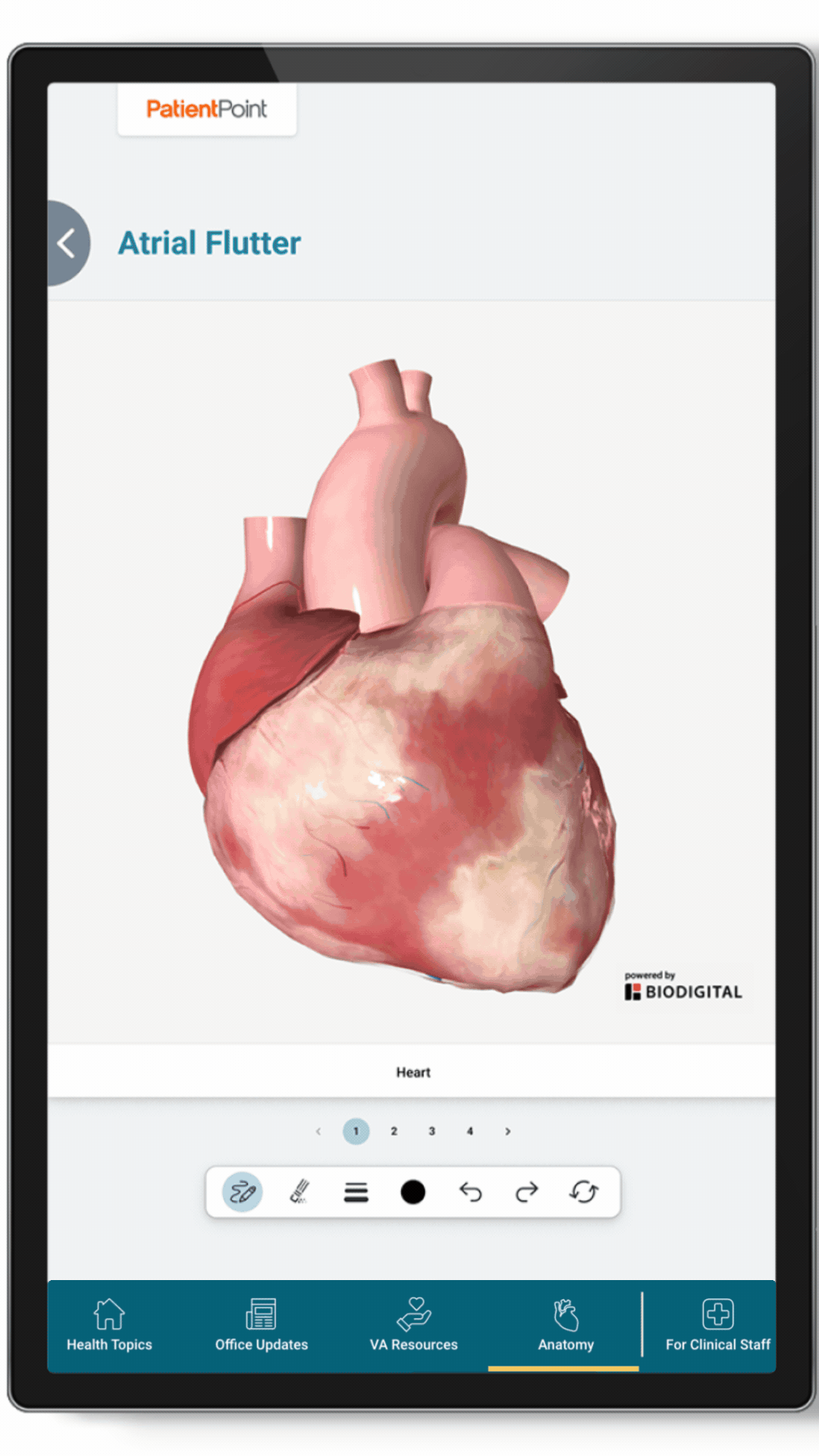 Animated 3D model of a human heart demonstrating atrial flutter, switches to a custom message for My HealtheVet, then switches to a video for Tips for Eating with Diabetes, then switches to a menu that links to VA Resources and links, displayed on a PatientPoint Government exam room screen.