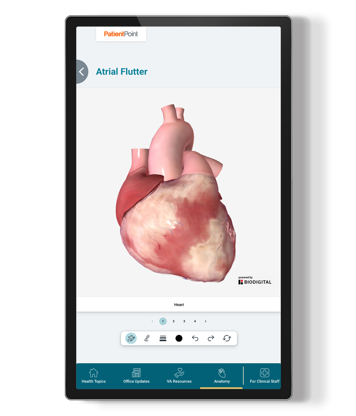 Exam room screen displaying a 3D digital model of a human heart labeled Atrial Flutter, with navigation and anatomy menu options.